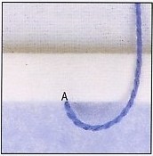 Петельный шов