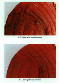 пурпуон до и после реставрации