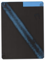 ренгеннограмма клинка 10-го века